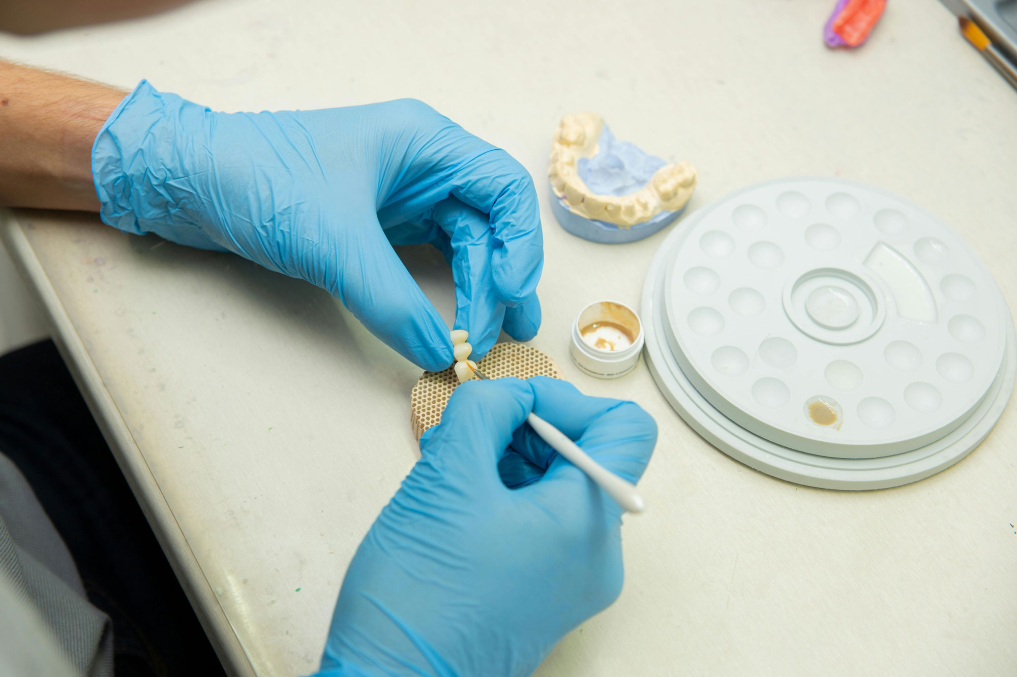 Dental Implant Maintenance