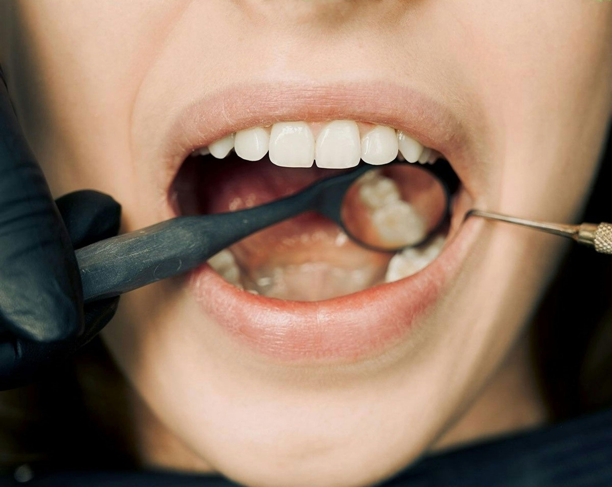 Dental Misconceptions