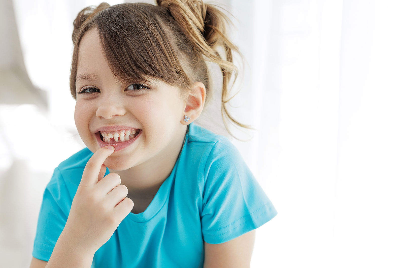 Fluoride Toxicity