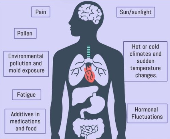 Combat Mast Cell Activation Syndrome (MCAS) with a Holistic Dentist