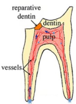Risks of Root Canal Therapy