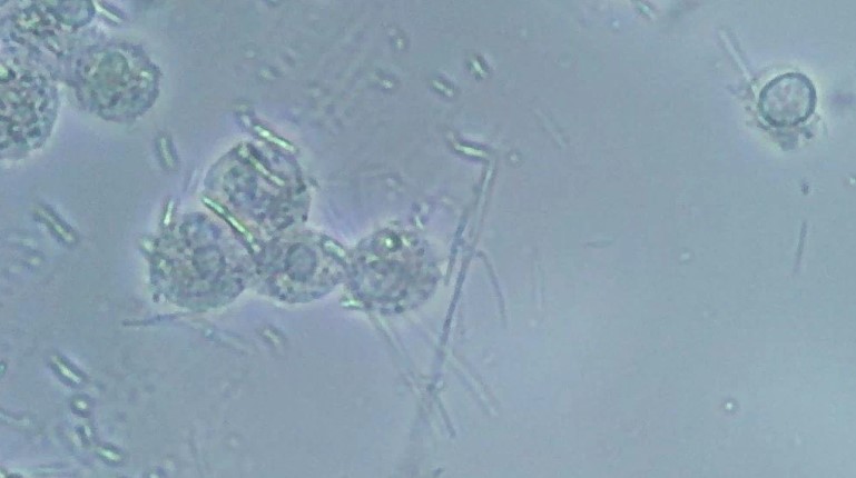 Anaerobic Bacteria in the Mouth