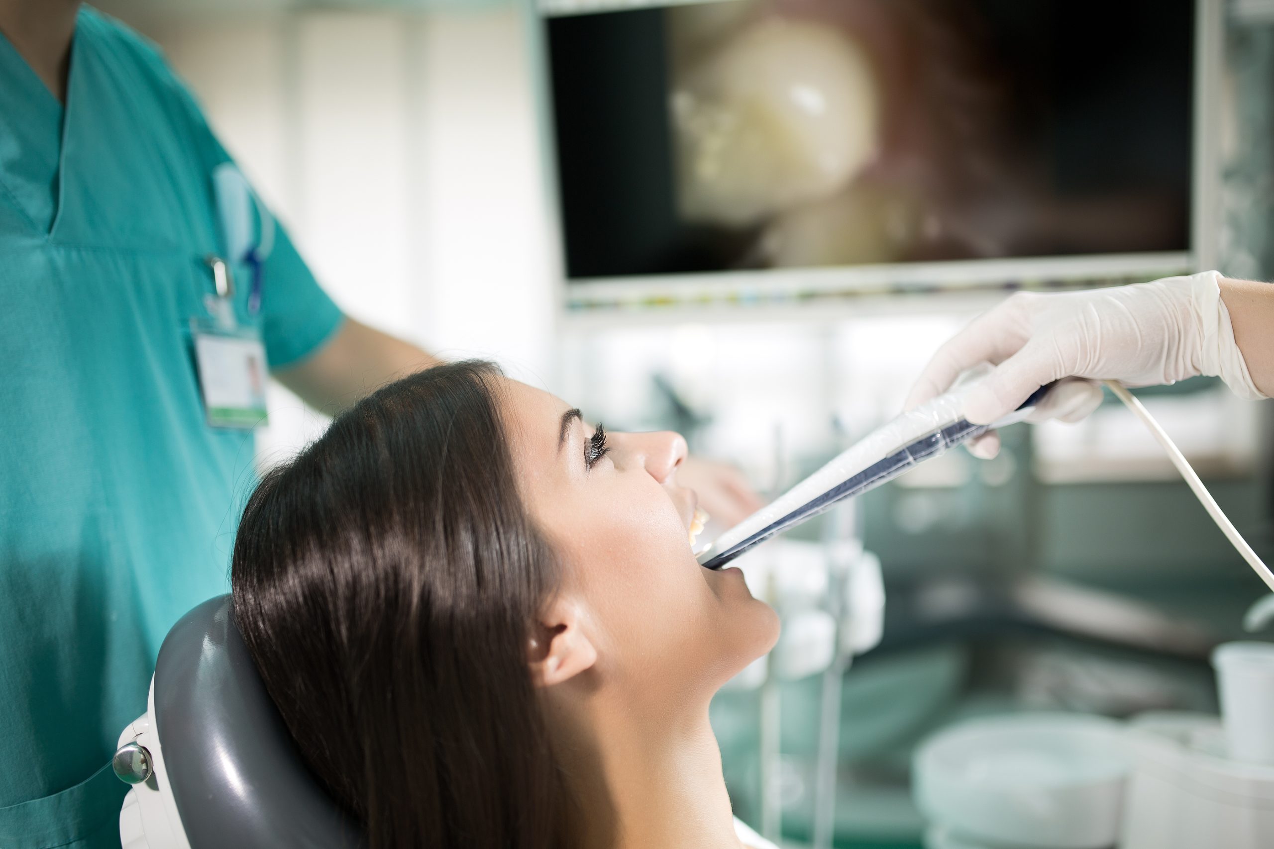 What You Need to Know About Root Canals