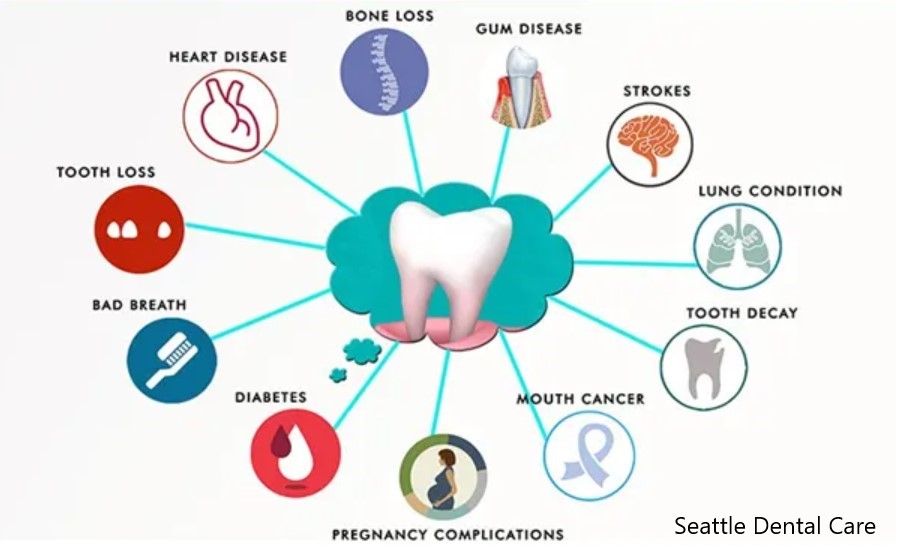 Top 6 Systemic Health Risks Caused by Infected Root Canals