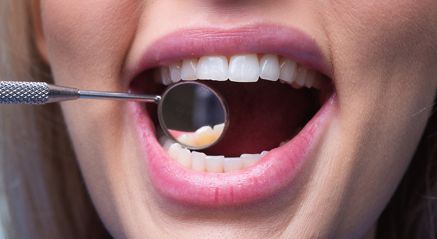 Holistic Approaches to Preventative Dentistry: What Sets It Apart?
