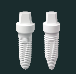 Ceramic Implants