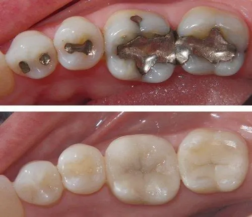 Holisitic Dentist Alaska Holisitic Dentist Alaska