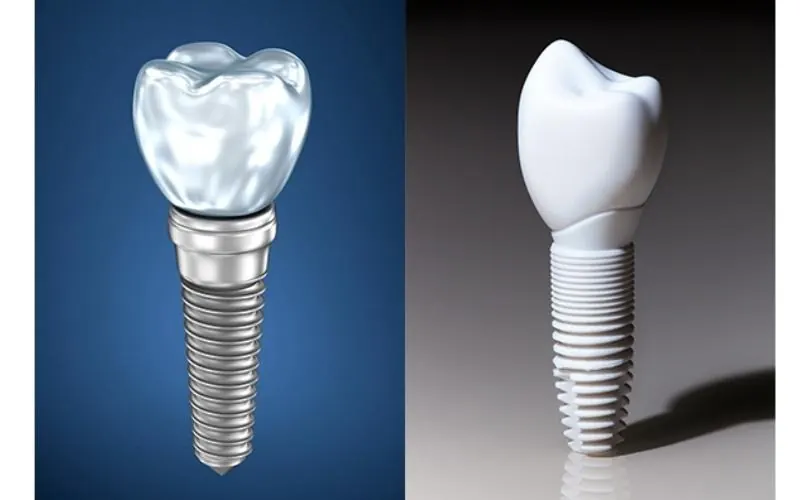 Holisitic Dentist Alaska Holisitic Dentist Alaska