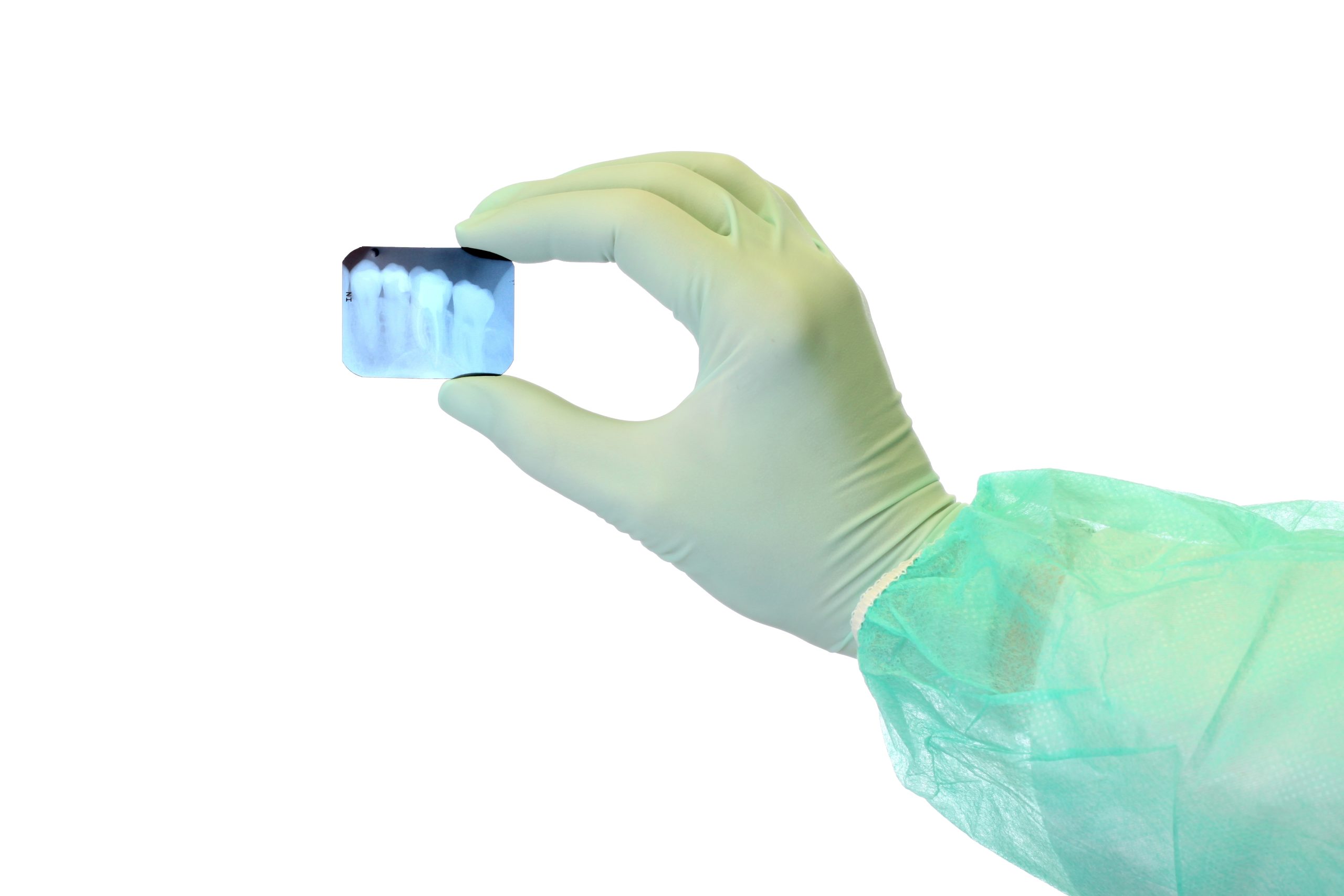 The Deep Truth: Do Root Canals Really Affect Your Health?
