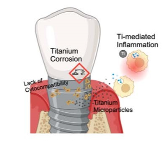 Beyond the Mouth: The Systemic Risks of Titanium Implant Allergy & Metal Toxicity