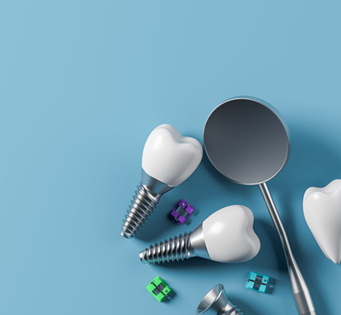 Top 6 Difference between Zirconia vs. Titanium Implant